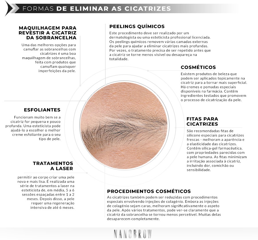 FORMAS DE ELIMINAR AS CICATRIZES: Esfoliantes, Peelings químicos, Cosméticos, Fitas para cicatrizes, Procedimentos cosméticos, Tratamentos a laser, Maquilhagem para revestir a cicatriz da sobrancelha